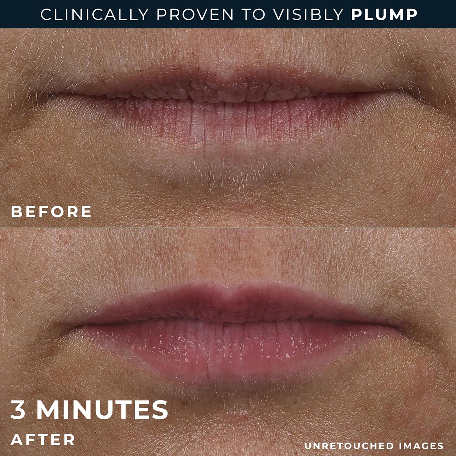 Balsam Volum Buze Strălucitoare